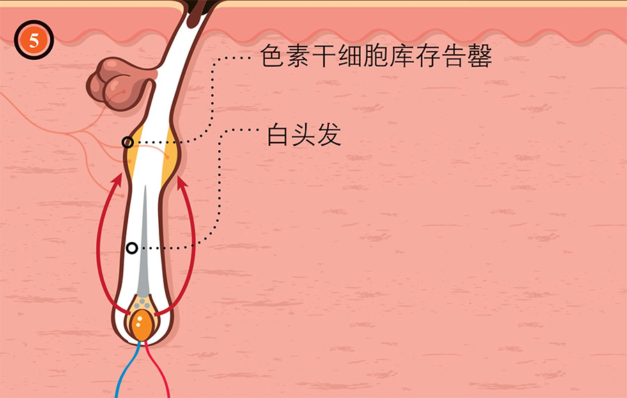 新发现：人类头发变白原因与防治新途径，研究揭示干细胞“卡住”现象