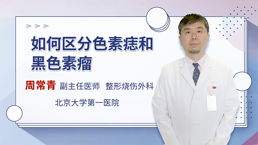 如何分别普通的痣和黑色素瘤？看专家的建议吧！